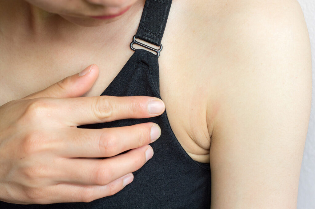 Does Itchy Breast Mean Cancer