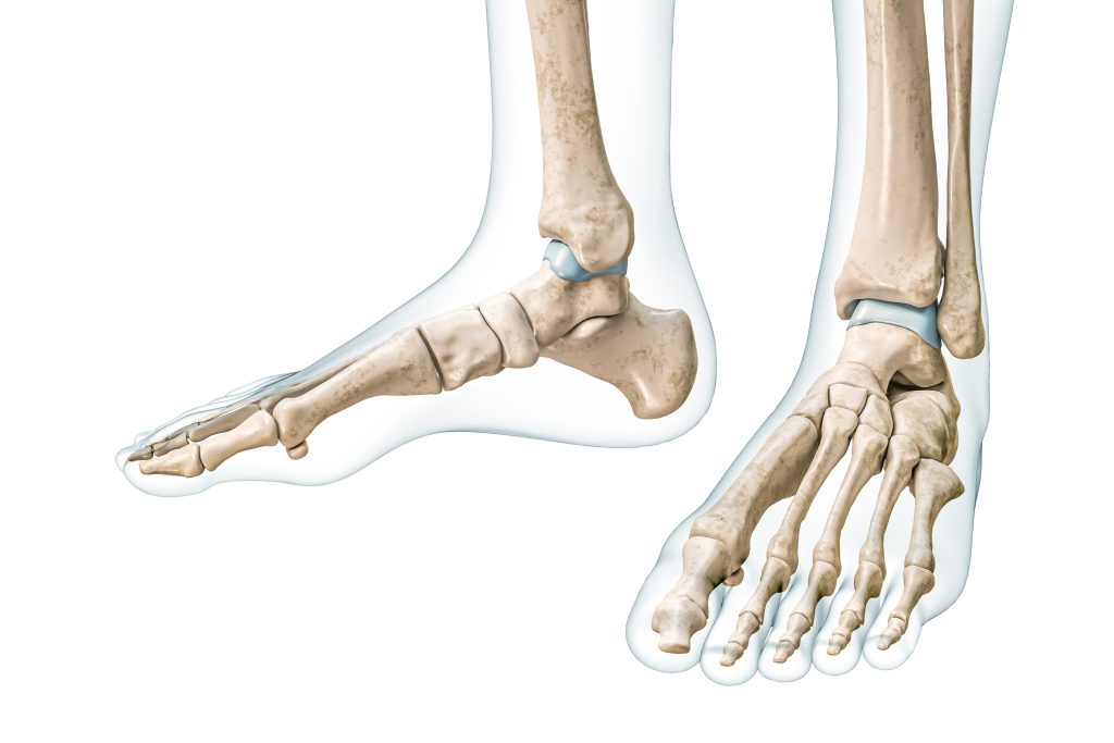 What Is Bone Marrow Edema