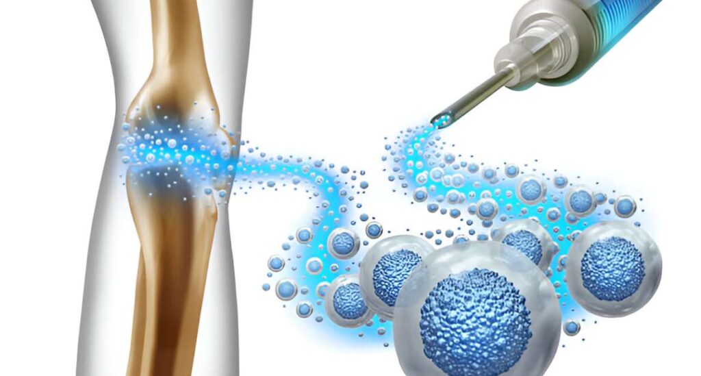 What Is Bone Marrow Transplant?